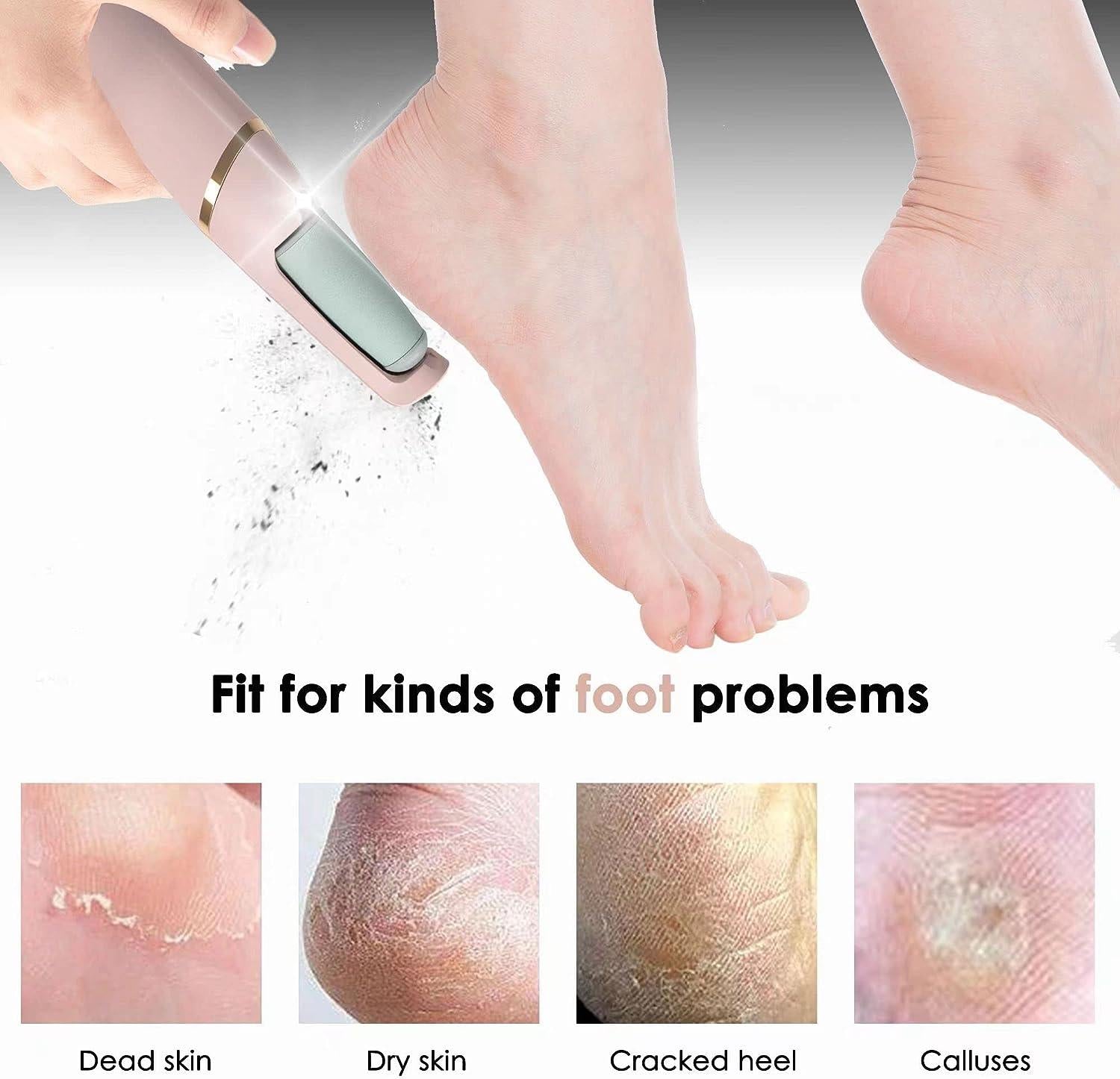 Multifunctional Dual-SpeedCallus Remover